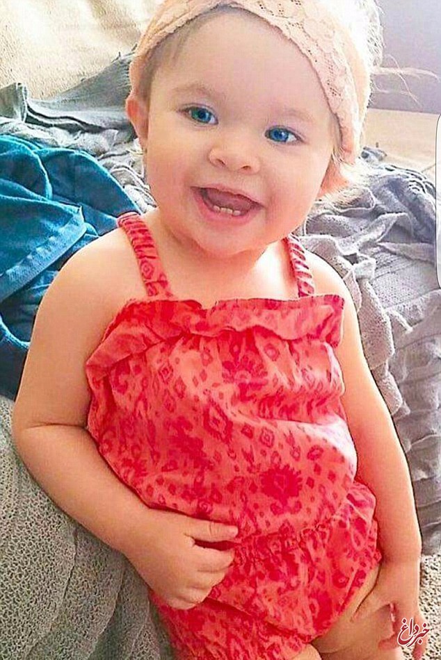اشتباه پزشکی کودک 14 ماهه را به کشتن داد+عکس