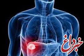 حدود ۴۰ درصد ایرانیان مبتلا به کبدچرب هستند/ توصیه‌های رژیمی برای افراد دیابتی