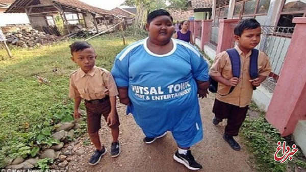 چاق ترین کودک جهان!! + عکس