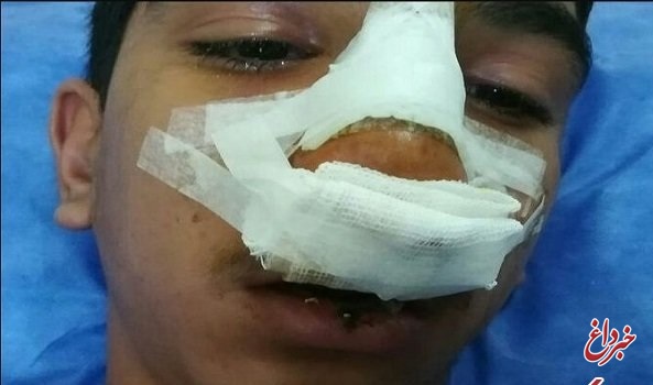 دادستان عمومی: مدیر مدرسه فاریابی جیرفت بازداشت شد / اقرار به شکستگی استخوان بینی و پارگی لب دانش‌آموز