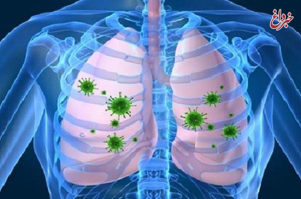 عفونت تنفسی ریسک بیماری قلبی را ۱۷ برابر افزایش می‌دهد