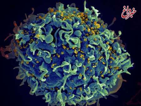 کشف دلیل پایداری ویروس آچ‌آی‌وی