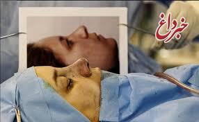 ماهیانه چند هزار عمل جراحی زیبایی بینی در تهران انجام می‌شود؟!