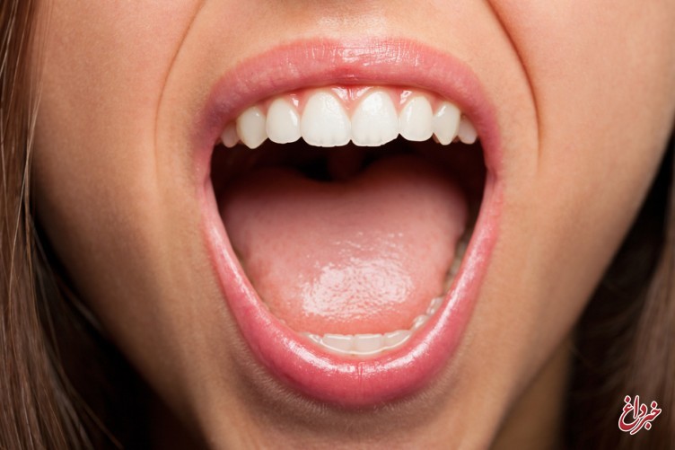 توصیه های مفید برای درمان زخم دهان