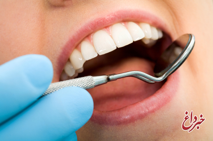 عوارض لمینیت دندان به جای ارتودنسی