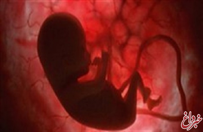 افزایش سقط‌درمانی در تهران/ با چه شرایطی می‌توان مجوز سقط جنین گرفت؟