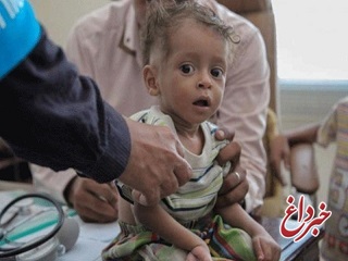 یونیسف: هر 10 دقیقه یک کودک یمنی می میرد