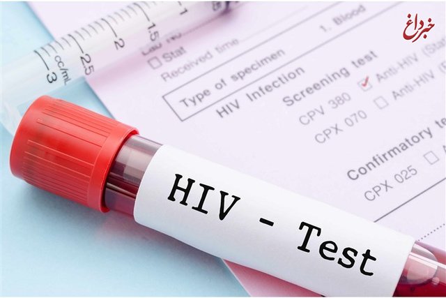 چگونه عفونت HIV بیماری 