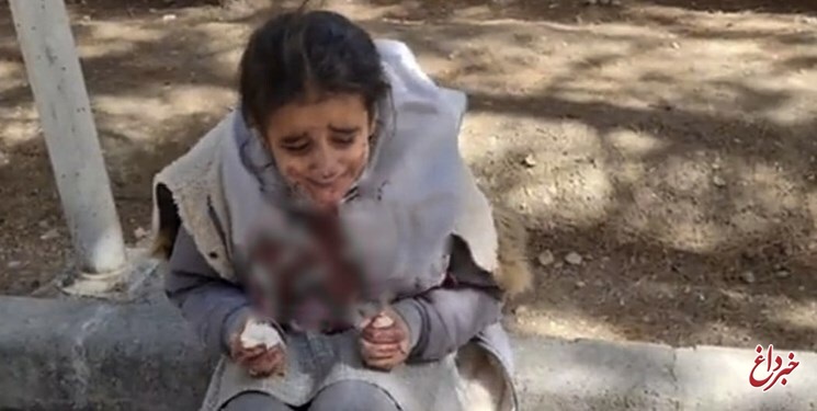 ماجرای دختر دانش‌آموز اصفهانی با صورت خون‌آلود چه بود؟ / پلیس: ماجرا دعوای دو دانش آموز بوده؛ ورود مادر یکی از آنها منجر به آسیب دیدن این دختر می‌شود
