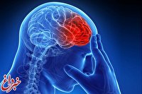 مهم‌ترین علامت سکته مغزی/ زمان طلایی درمان سکته مغزی چقدر است؟