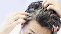 شناسایی ۶ وضعیت پزشکی از ظاهر موی سر