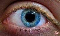 تشخیص زودهنگام یک بیماری خطرناک با نگاه به چشم