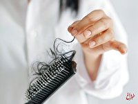 جلوگیری از ریزش مو در زنان با انجام این سه کار