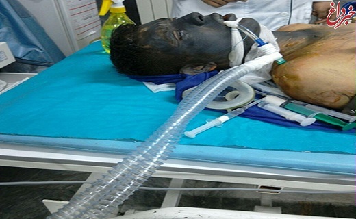 مرگ نوجوان قزوینی بر اثر انفجار مواد محترقه