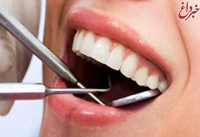 ﻿فلوراید تراپی یکی از راههای پیشگیری از پوسیدگی دندانهای کودکان