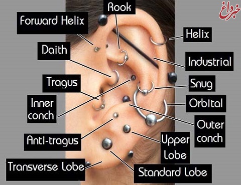 تاثیر سوراخ کردن گوش بر درمان سردرد و میگرن + عکس