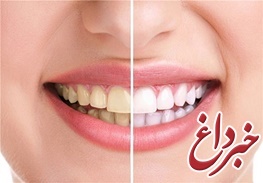 این مواد غذایی دندان‌هایتان را سفید می‌کنند