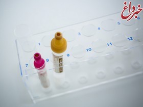 آزمایش جدید خون برای تسریع تولید داروی هوشمند سرطان