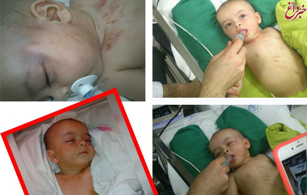 تصاویر دلخراش از آزار نوزاد 5 ماهه در رشت