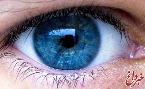 تشخیص پارکینسون با معاینه ساده چشم