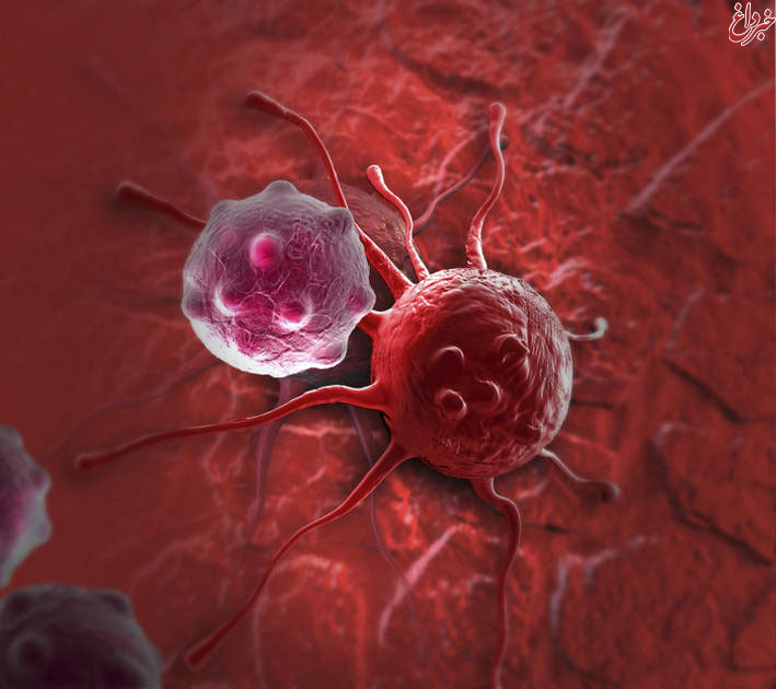 چگونه از ابتلا به سرطان سینه پیشگیری کنیم؟