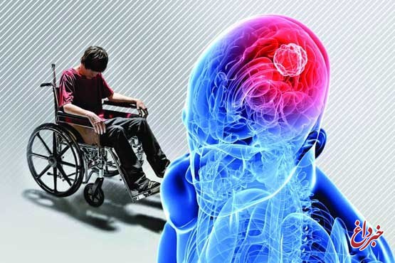 اگر این نشانهها را دارید مشکوک به ام اس هستید اگر این نشانهها را دارید مشکوک به ام اس هستید
