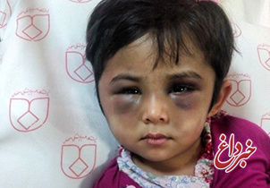 ضرب و شتم کودک 4 ساله توسط برادرش/ نامشخص بودن هویت کودک اصفهانی