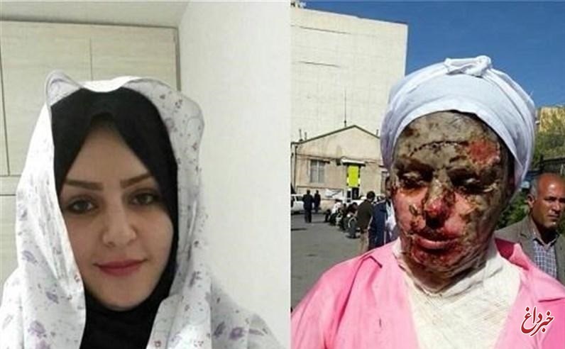 دانشگاه علوم پزشکی تبریز: هزینه‎ای برای درمان قربانی اسیدپاشی دریافت نشده است