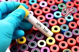 نرخ ۵ تا ۹ درصدی ابتلا به HPV در کشور/ سالانه نزدیک به ۳۰ هزار نفر به خاطر آلودگی هوا زودتر فوت می‌کنند