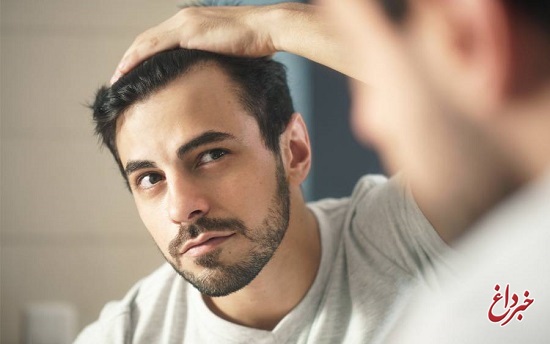۵ نکته برای پیشگیری از ریزش مو