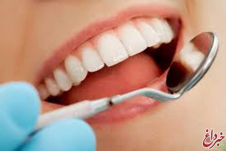 دلایل پوسیدگی دندان+روش پیشگیری