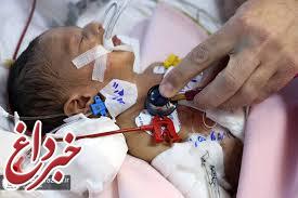 جراحی موفقیت‌آمیز نوزاد نارس در بیمارستان رضوی
