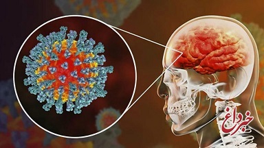 حمله ویروس کرونا به «مغز» ثابت شد