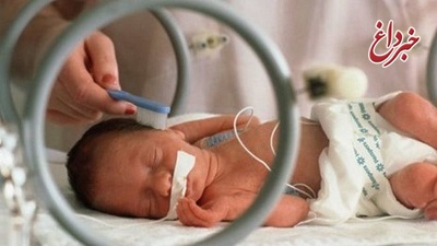 متخصص زنان و زایمان: مداخله در زمان تولد، خطر مرگ نوزاد را افزایش می‌دهد