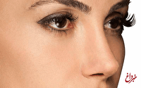 جراحی نوک بینی چگونه است؟