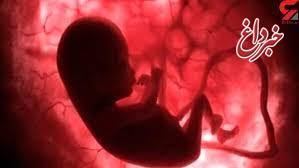 مجوز ۱۰هزار سقط جنین صادر شد
