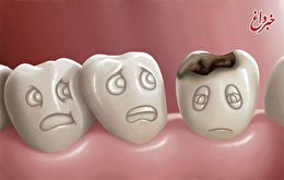 پنج عادت نادرستی که دندان‌هایتان را خراب می‌کند