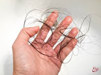 زنان بدانند؛ ۳ راه موثر برای جلوگیری از ریزش مو