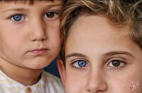 وقتی رنگ‌ چشم‌ها متفاوت است/ عکس