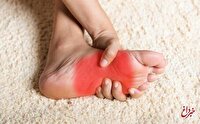 داغی و سوزش کف پا نشانه چیست؟/ با بهترین تسکین‌دهنده کف پای داغ آشنا شوید