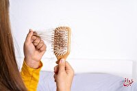 مصرف این ۳ خوراکی باعث ریزش مو می‌شود