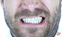 این میوه تهدید پنهان برای دندان‌ها است