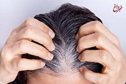 یافتهای جدید درباره سفید شدن مو یافتهای جدید درباره سفید شدن مو
