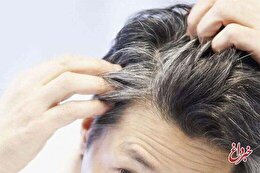 طب سنتی در مورد علت سفیدی مو چه می‌گوید؟