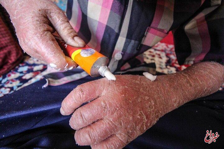 ماجرای رها شدن یک نوزاد پروانه‌ای در بیمارستان