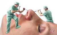 چرا شیادها در بازار جراحی زیبایی کاسبی شان پررونق است؟